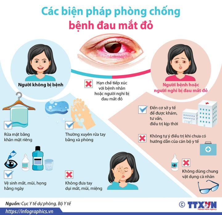 ĐAU MẮT ĐỎ